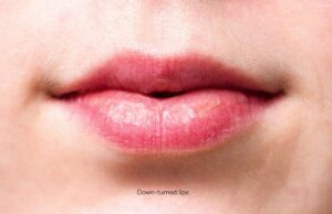 m-shaped lips