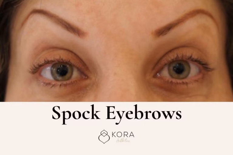 spock eyebrows after botox scottsdale